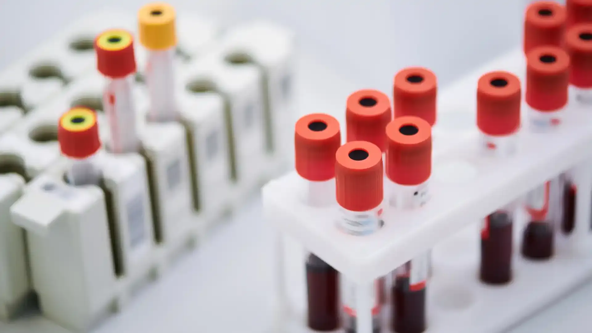 lab test