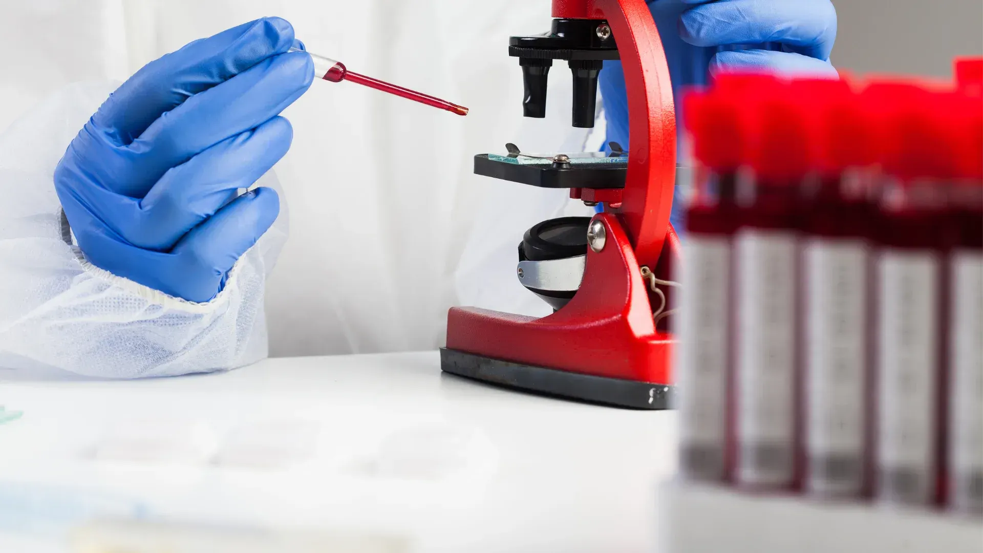 blood test
