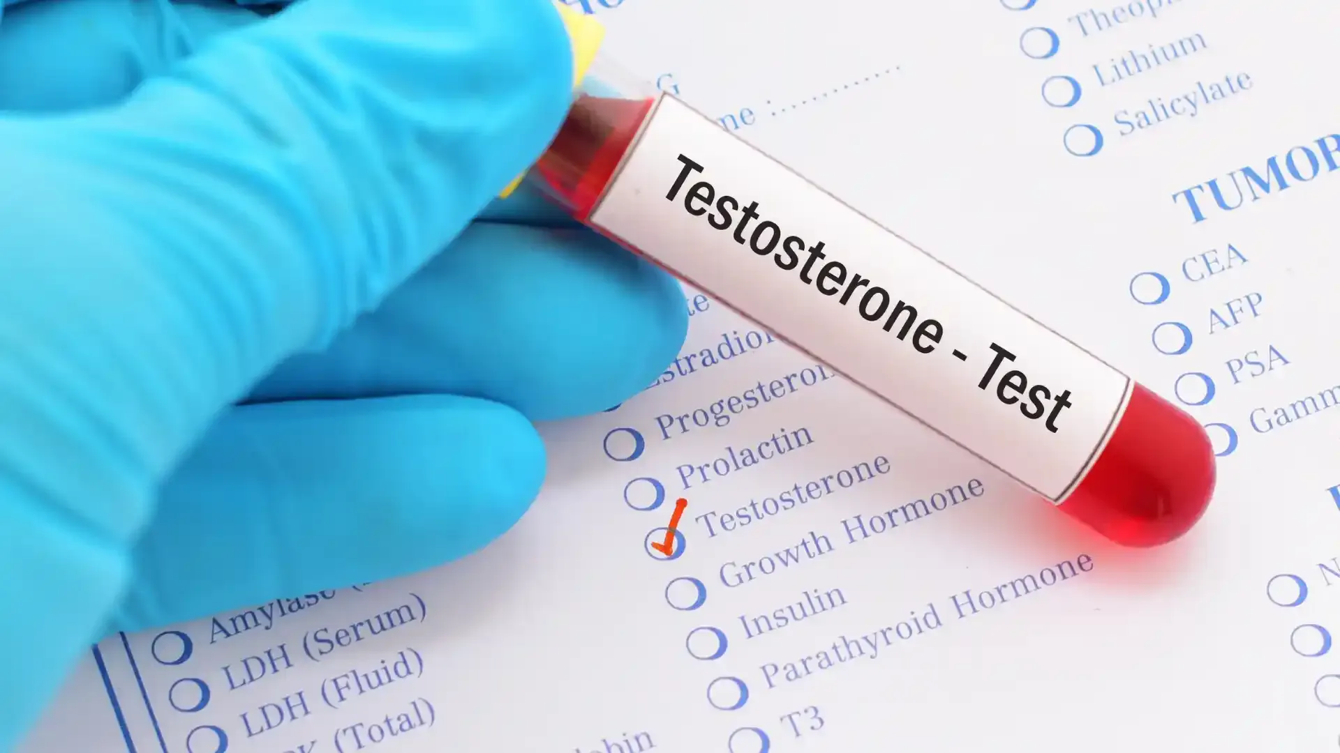 testosterone test