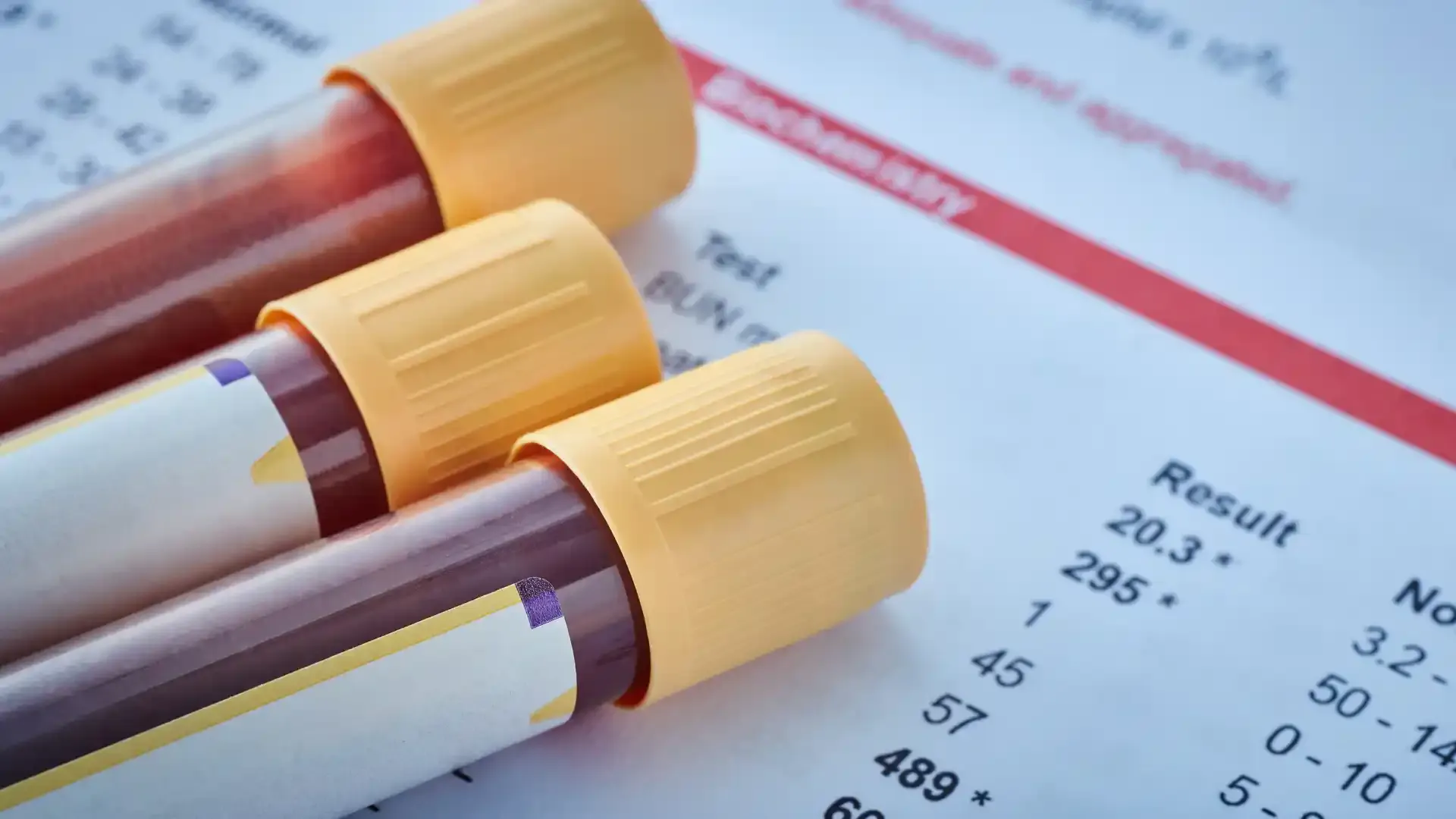 blood test for men
