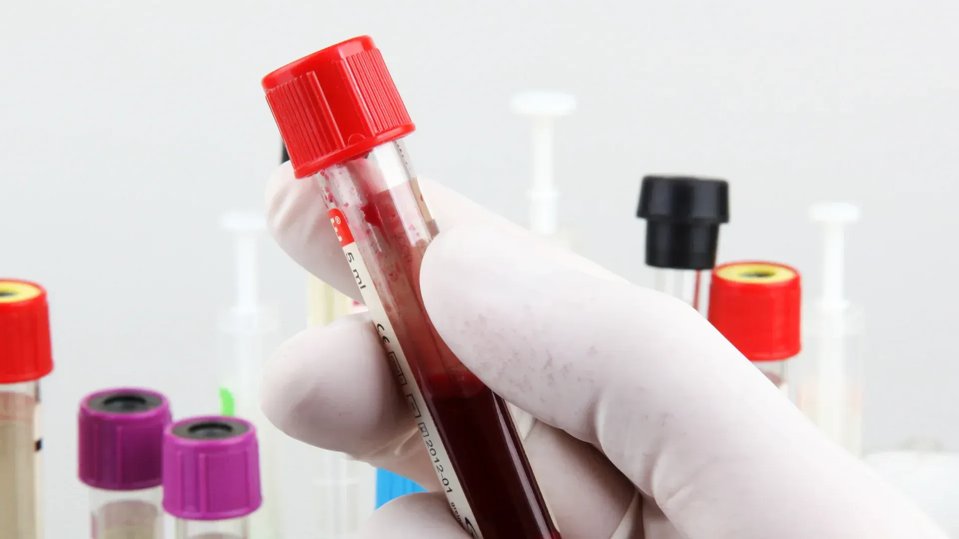 blood work nearby