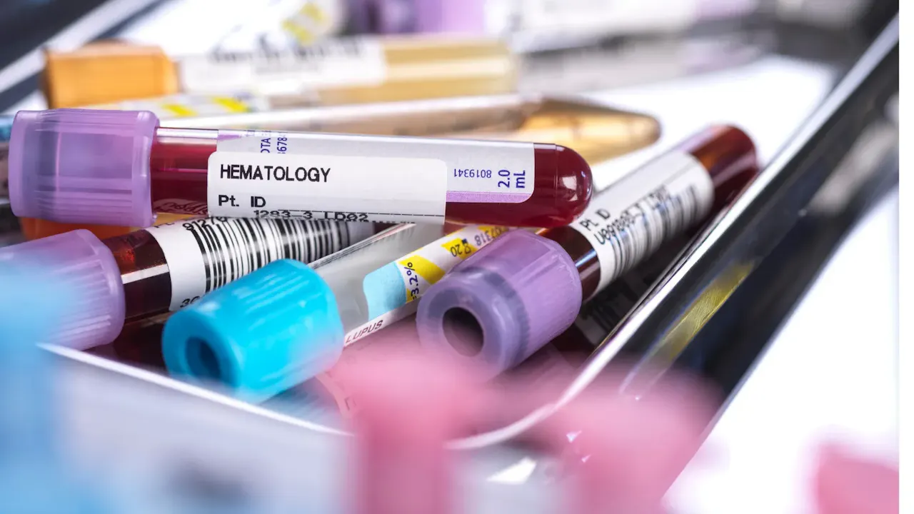 complete blood count