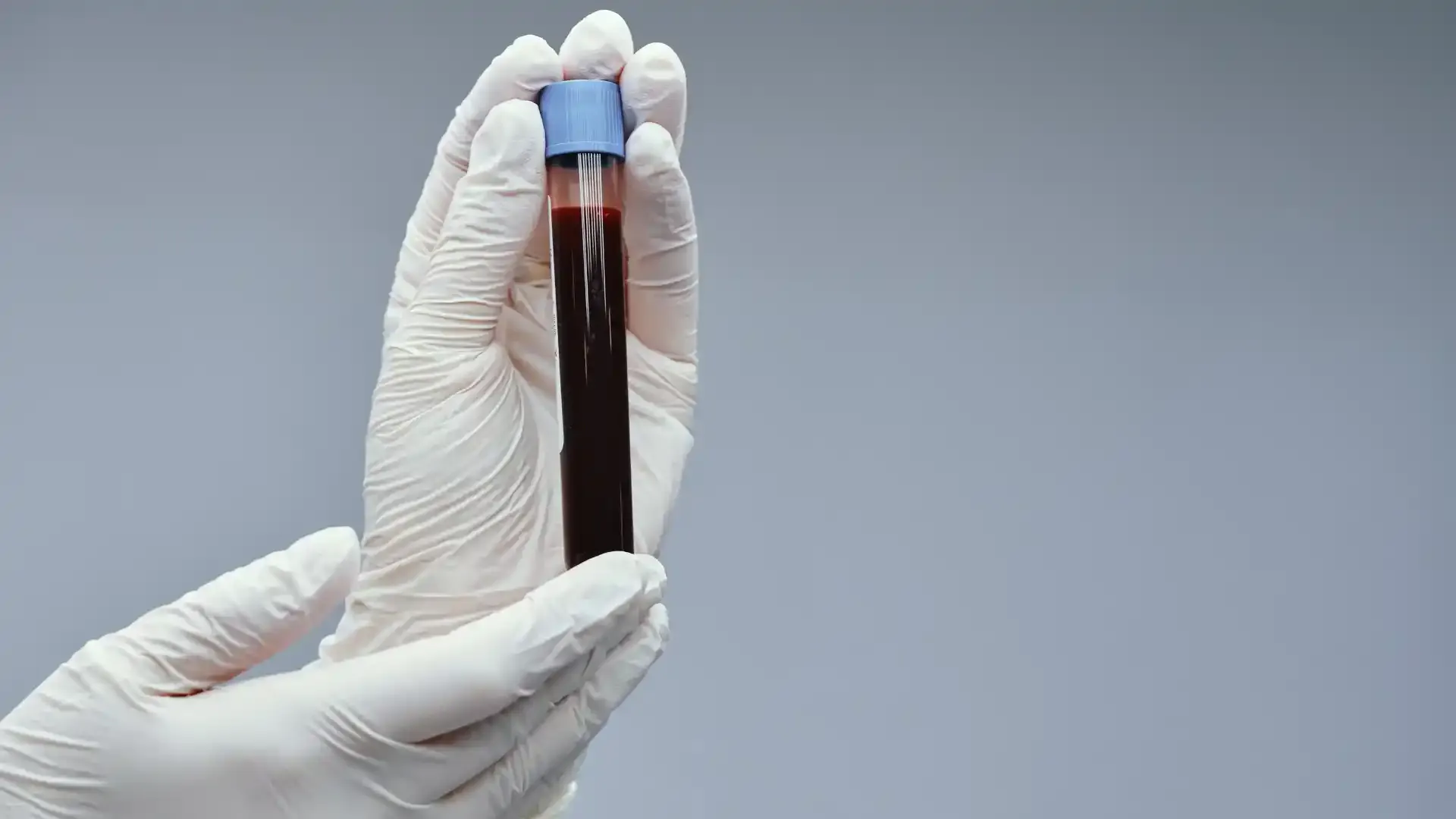 blood sample