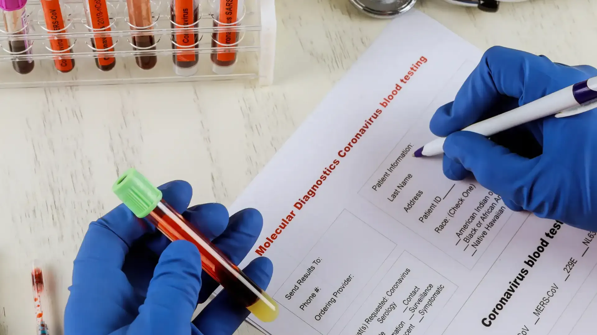 own lab tests
