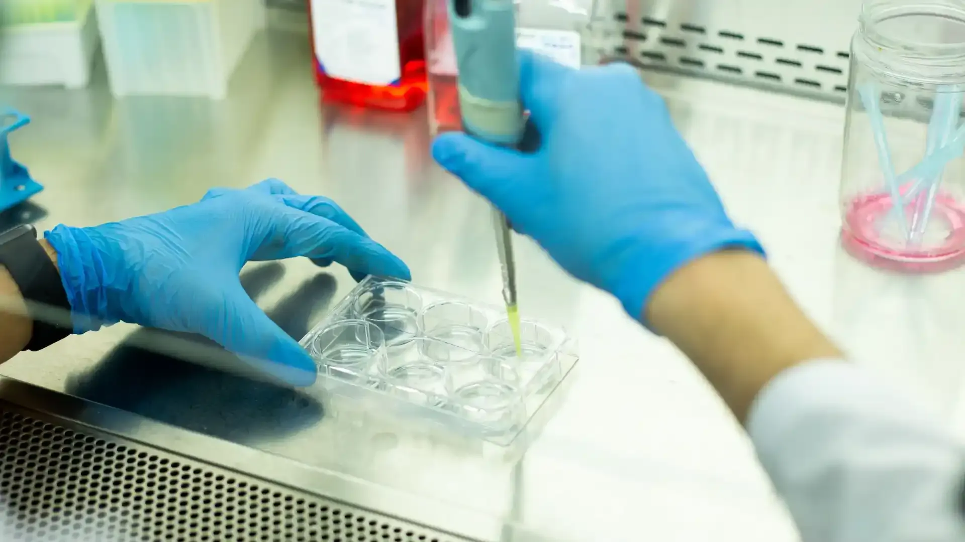 stem cell treatment