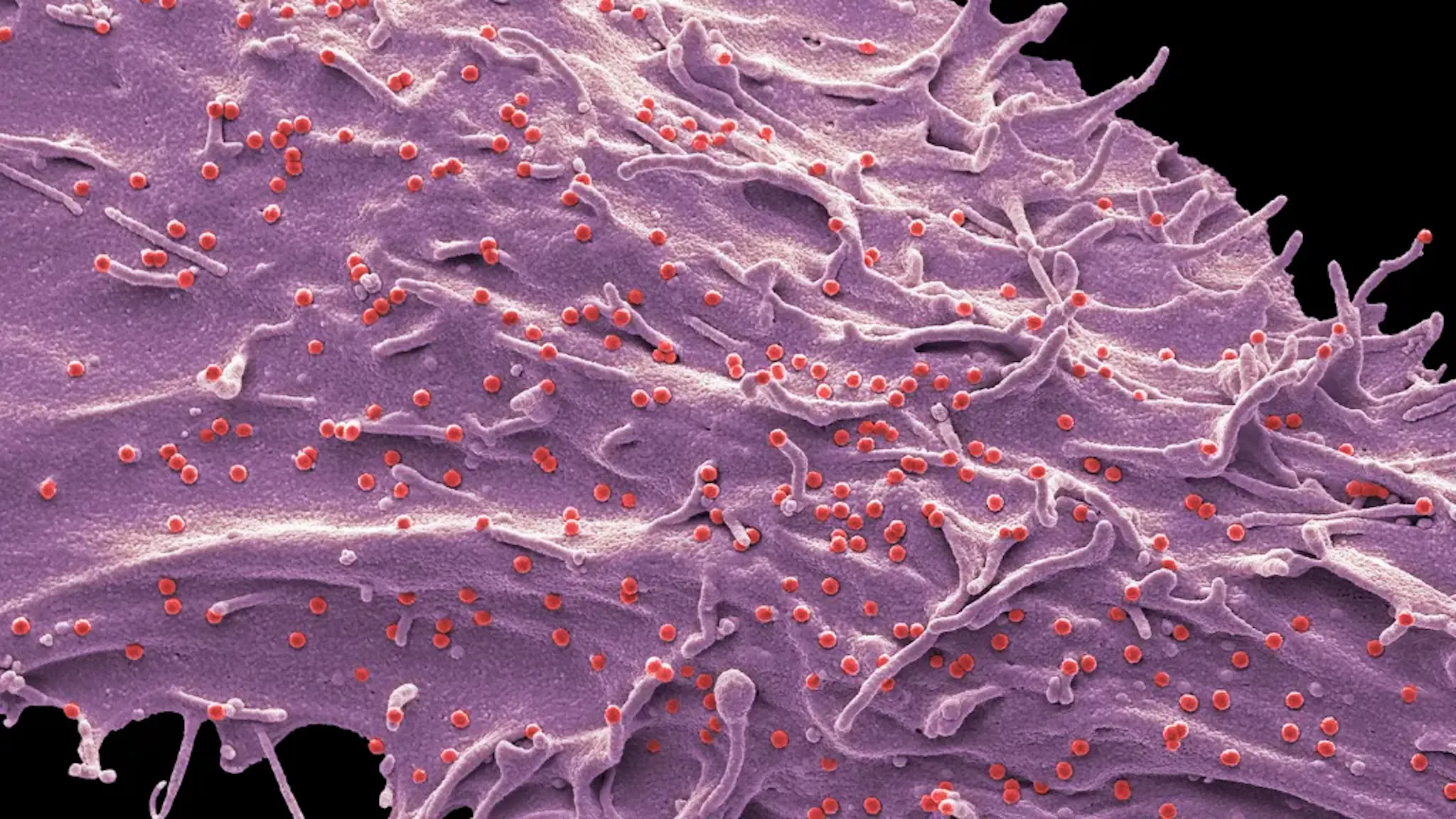 exosomes