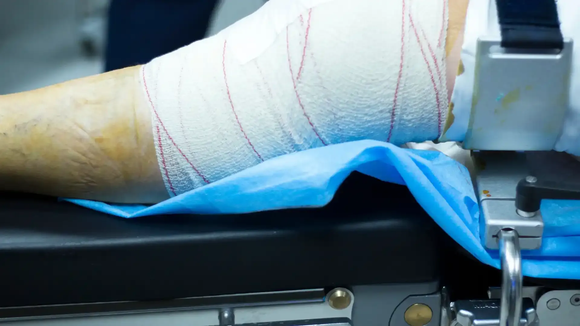 knee meniscus tears