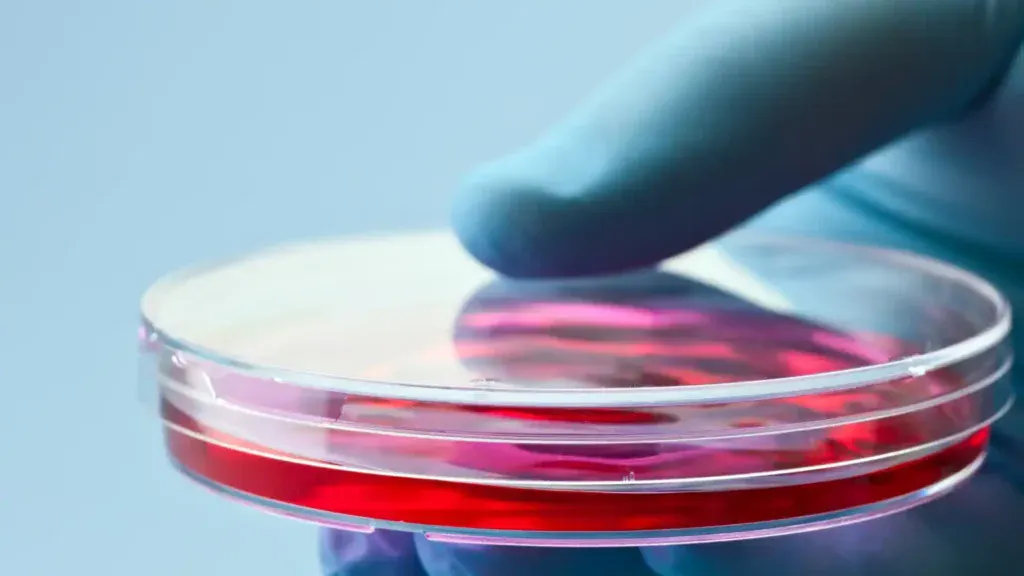 stem cell treatment