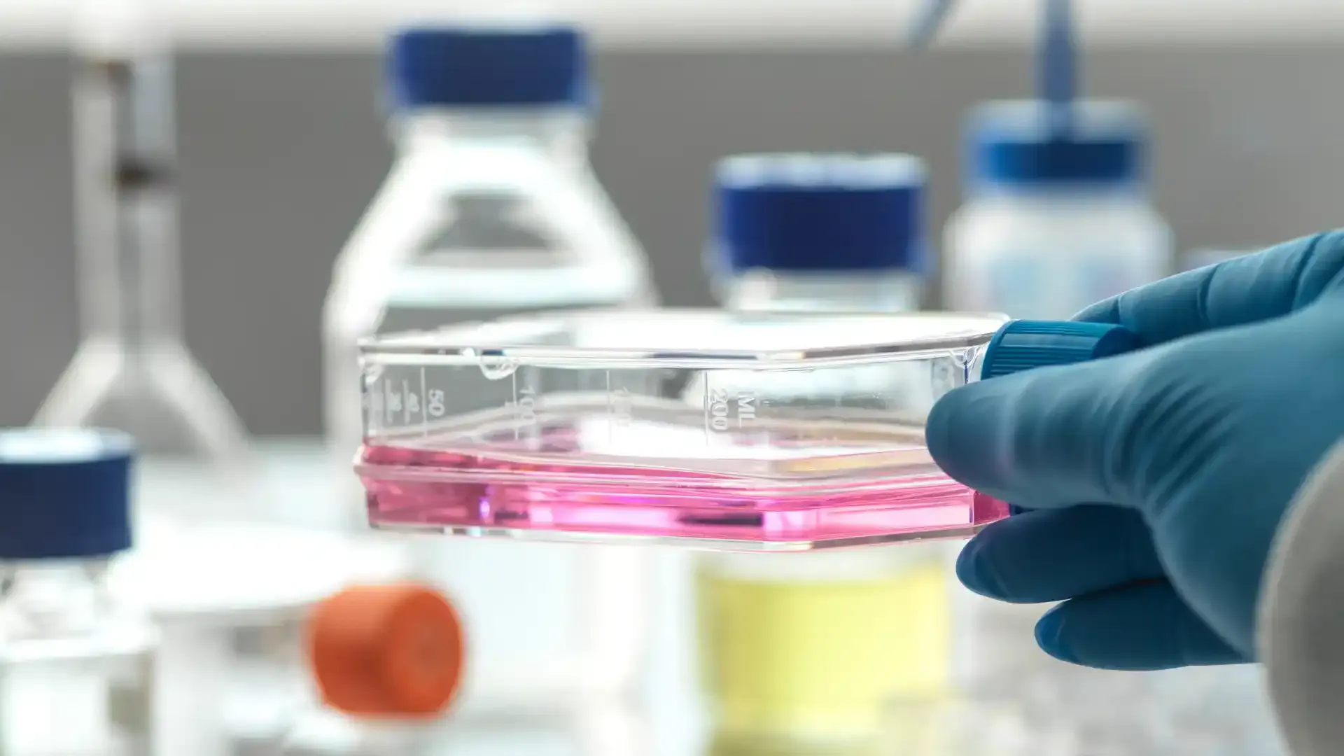 hematopoietic stem cell transplantation