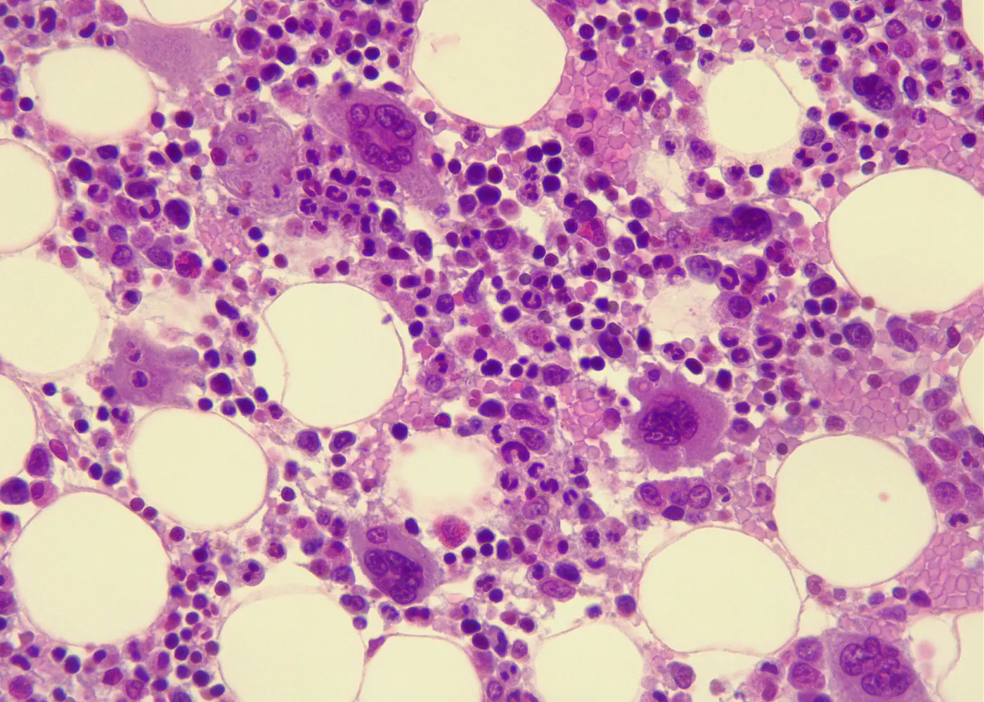 stem cell in penis