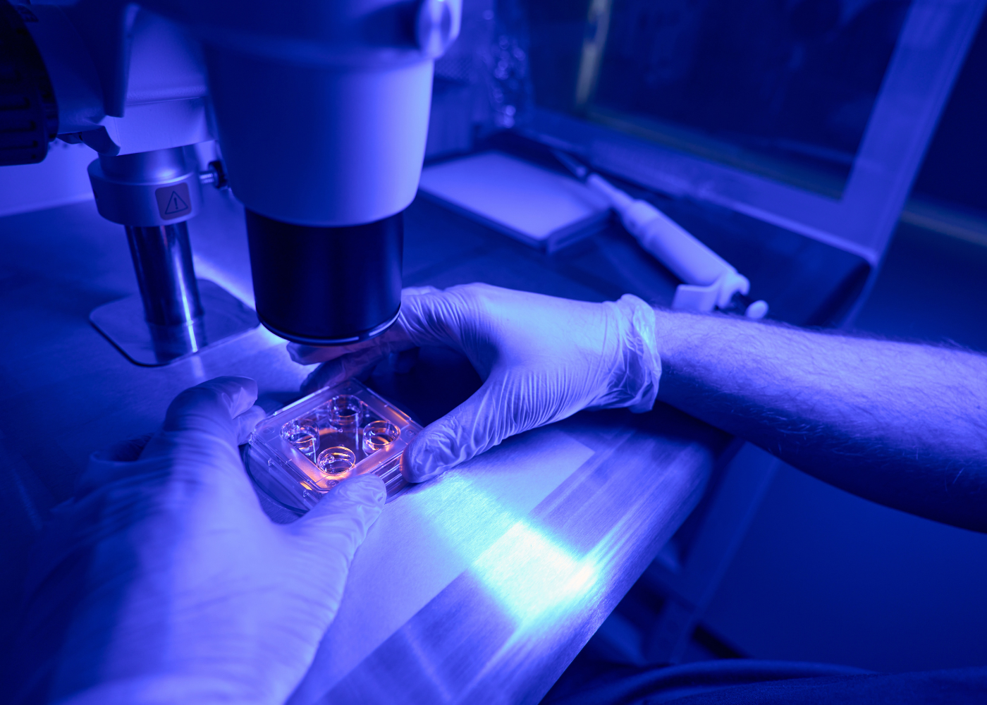 stem cell vs bone marrow transplant