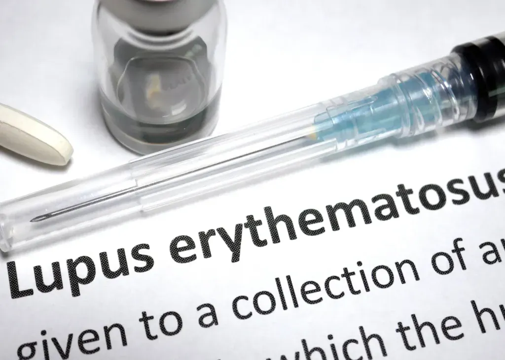lupus