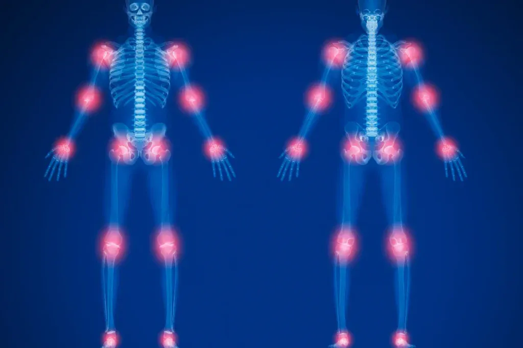 joint instability