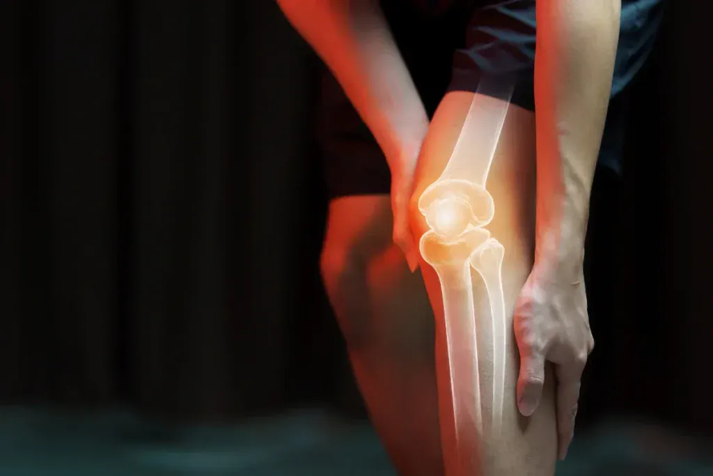 patellofemoral pain syndrome