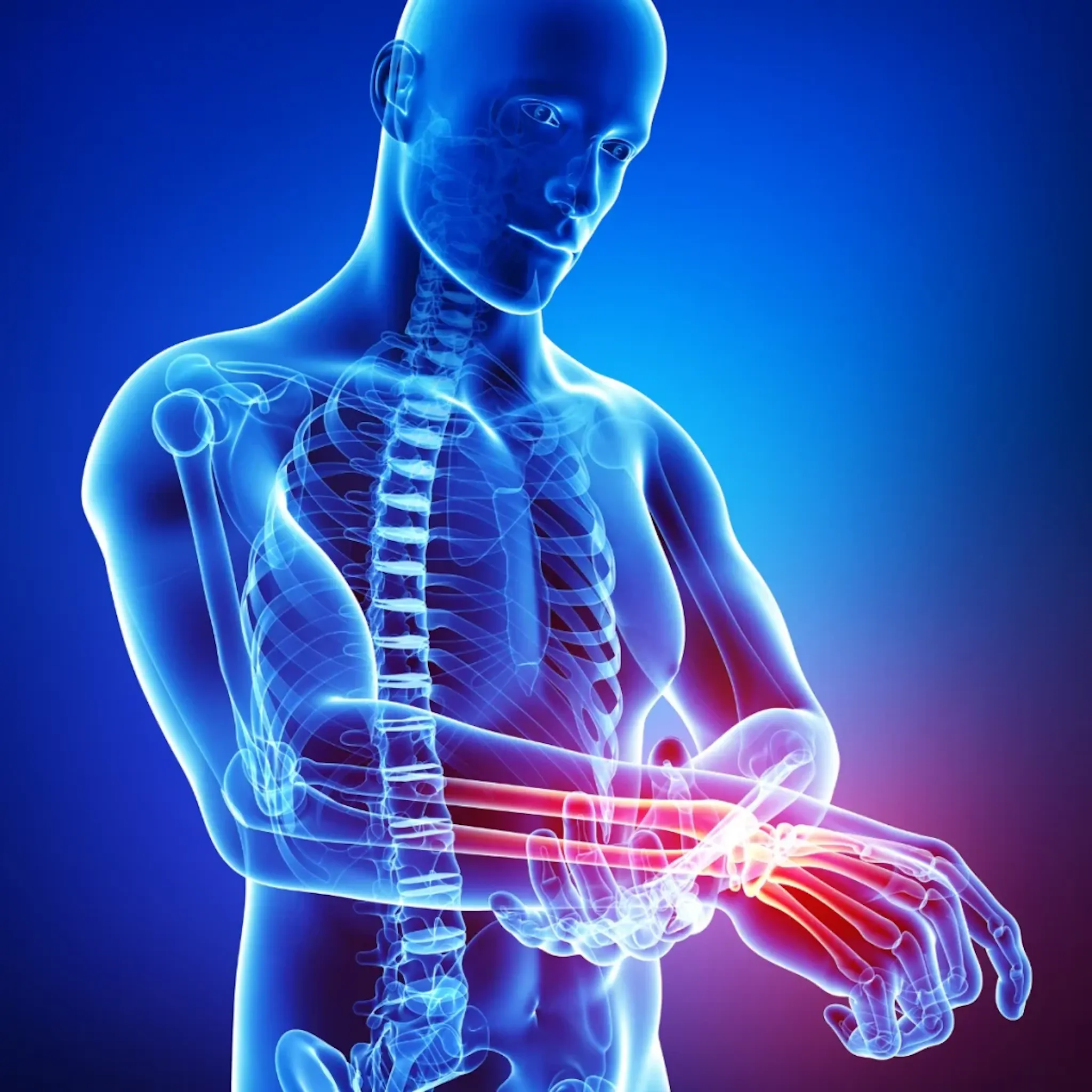 carpal tunnel syndrome symptoms