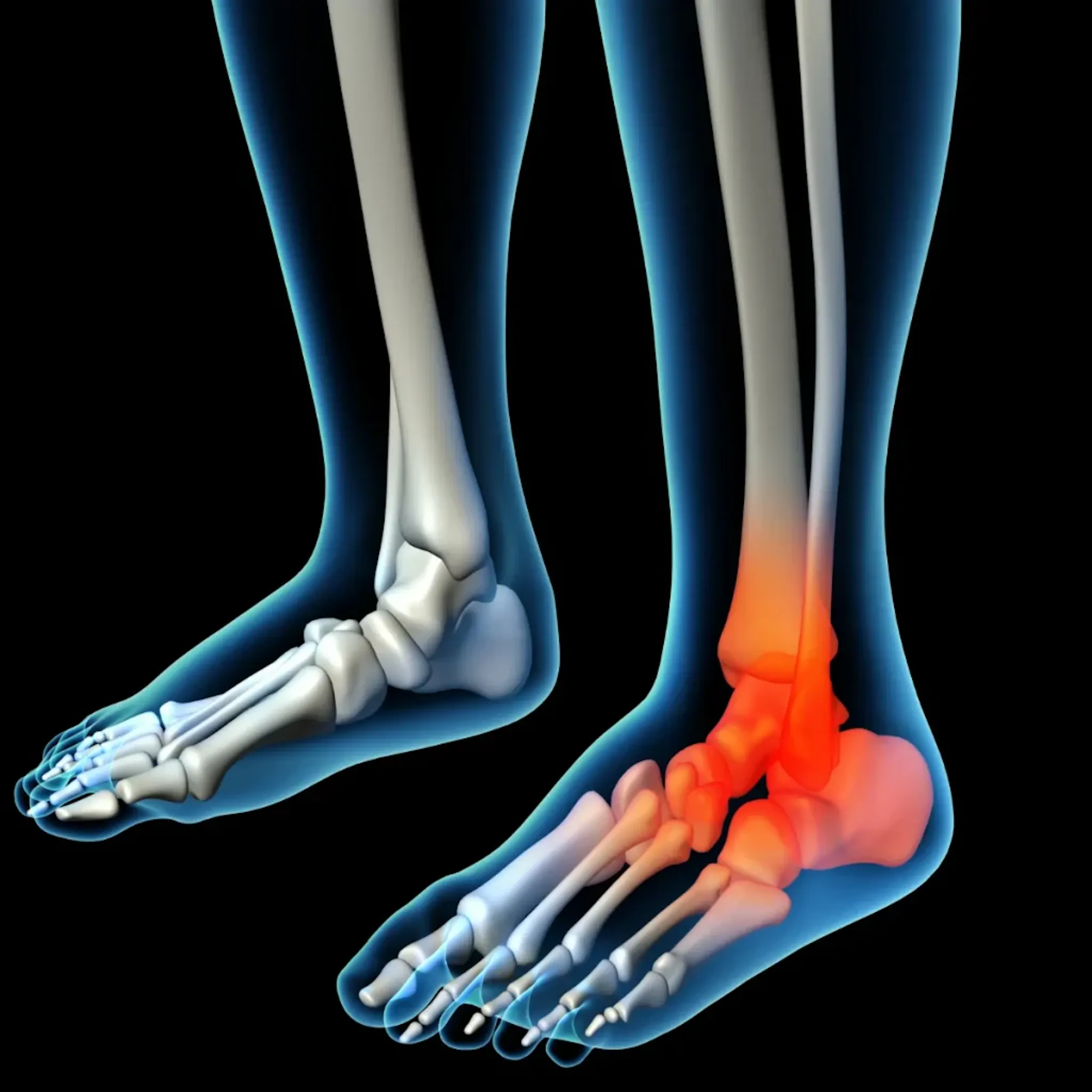 morton's neuroma treatments